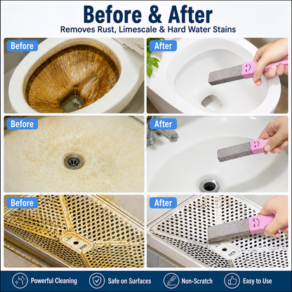 🔥 Hot Sale | 12 Pcs Toilet Pumice Stone Pumice Stone for Cleaning with 3 Handle