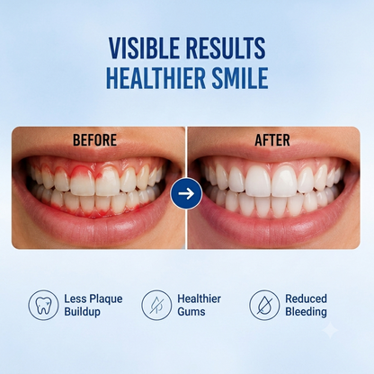🔥Bestseller | Anti-Gingivitis Oral Rinse with 0.05% CPC