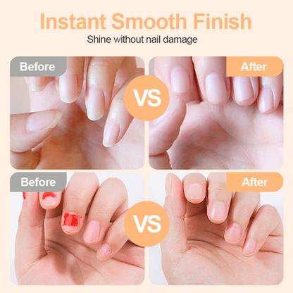 💅 LIMITED-TIME 50% OFF!  ✂️2-in-1 Smart Electric Nail Clipper & Polisher